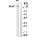 Western blot analysis of extracts from K562 cells, using STA13 antibody.