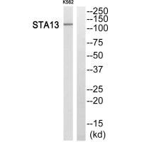 Western blot analysis of extracts from K562 cells, using STA13 antibody.