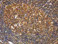 The image on the left is immunohistochemistry of paraffin-embedded Human tonsil tissue using CSB-PA805573(GNA13 Antibody) at dilution 1/20, on the right is treated with fusion protein. (Original magnification: ×200)