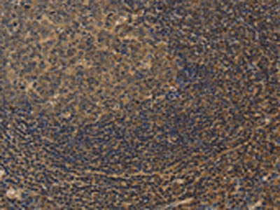 The image on the left is immunohistochemistry of paraffin-embedded Human tonsil tissue using CSB-PA806953(CXXC5 Antibody) at dilution 1/25, on the right is treated with fusion protein. (Original magnification: ×200)