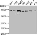 Western Blot
Positive WB detected in: 293T whole cell lysate, U251 whole cell lysate, HepG2 whole cell lysate, 293 whole cell lysate, A549 whole cell lysate, MCF-7 whole cell lysate, PC3 whole cell lysate
All lanes: AMOTL2 antibody at 1:2000
Secondary
Goat polyclonal to rabbit IgG at 1/50000 dilution
Predicted band size: 86, 92 kDa
Observed band size: 86 kDa