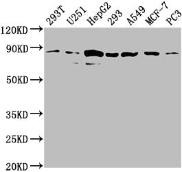 Western Blot
Positive WB detected in: 293T whole cell lysate, U251 whole cell lysate, HepG2 whole cell lysate, 293 whole cell lysate, A549 whole cell lysate, MCF-7 whole cell lysate, PC3 whole cell lysate
All lanes: AMOTL2 antibody at 1:2000
Secondary
Goat polyclonal to rabbit IgG at 1/50000 dilution
Predicted band size: 86, 92 kDa
Observed band size: 86 kDa