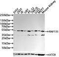 Western blot All lanes: RNF135 antibody at 3.51µg/ml Lane 1: 293T whole cell lysate Lane 2: Jurkat whole cell lysate Secondary Goat polyclonal to rabbit IgG at 1/10000 dilution Predicted band size: 48, 23, 31 kDa Observed band size: 48 kDa