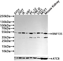 Western blot All lanes: RNF135 antibody at 3.51µg/ml Lane 1: 293T whole cell lysate Lane 2: Jurkat whole cell lysate Secondary Goat polyclonal to rabbit IgG at 1/10000 dilution Predicted band size: 48, 23, 31 kDa Observed band size: 48 kDa