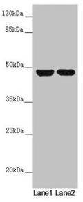 Western blot All lanes: RNF135 antibody at 5.88µg/ml Lane 1: 293T whole cell lysate Lane 2: Jurkat whole cell lysate Secondary Goat polyclonal to rabbit IgG at 1/10000 dilution Predicted band size: 48, 23, 31 kDa Observed band size: 48 kDa