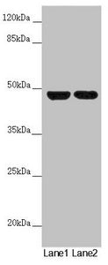 Western blot All lanes: RNF135 antibody at 5.88µg/ml Lane 1: 293T whole cell lysate Lane 2: Jurkat whole cell lysate Secondary Goat polyclonal to rabbit IgG at 1/10000 dilution Predicted band size: 48, 23, 31 kDa Observed band size: 48 kDa