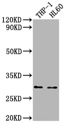 Western Blot
Positive WB detected in: THP-1 whole cell lysate, HL60 whole cell lysate
All lanes: OSCAR antibody at 1:2000
Secondary
Goat polyclonal to rabbit IgG at 1/50000 dilution
Predicted band size: 31, 29, 30, 28 kDa
Observed band size: 31 kDa