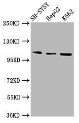 Western Blot
Positive WB detected in: SH-SY5Y whole cell lysate, HepG2 whole cell lysate, K562 whole cell lysate
All lanes: ULK2 antibody at 2.9µg/ml
Secondary
Goat polyclonal to rabbit IgG at 1/50000 dilution
Predicted band size: 113 kDa
Observed band size: 113 kDa