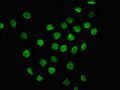 Immunofluorescence staining of A549 cells with CSB-PA815545LA01HU at 1:100, counter-stained with DAPI. The cells were fixed in 4% formaldehyde, permeabilized using 0.2% Triton X-100 and blocked in 10% normal Goat Serum. The cells were then incubated with the antibody overnight at 4&deg;C. The secondary antibody was Alexa Fluor 488-congugated AffiniPure Goat Anti-Rabbit IgG(H+L).