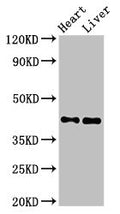 Western Blot
Positive WB detected in: Rat heart tissue, Mouse liver tissue
All lanes: MCAT antibody at 2.5ug/ml
Secondary
Goat polyclonal to rabbit IgG at 1/50000 dilution
Predicted band size: 43, 20 kDa
Observed band size: 43 kDa