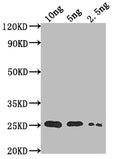 Western Blot
Positive WB detected in Recombinant protein
All lanes: TADA antibody at 1:2000
Secondary
Goat polyclonal to rabbit IgG at 1/50000 dilution
Predicted band size: 22.8 kDa
Observed band size: 25 kDa