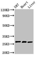 Western Blot
Positive WB detected in: U87 whole cell lysate, Rat heart tissue, Rat liver tissue
All lanes: HSCB antibody at 2.7µg/ml
Secondary
Goat polyclonal to rabbit IgG at 1/50000 dilution
Predicted band size: 28 kDa
Observed band size: 28 kDa