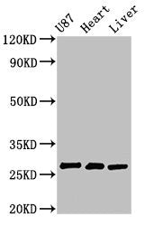 Western Blot
Positive WB detected in: U87 whole cell lysate, Rat heart tissue, Rat liver tissue
All lanes: HSCB antibody at 2.7µg/ml
Secondary
Goat polyclonal to rabbit IgG at 1/50000 dilution
Predicted band size: 28 kDa
Observed band size: 28 kDa