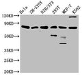 Western Blot
Positive WB detected in: Hela whole cell lysate, SH-SY5Y whole cell lysate, NIH/3T3 whole cell lysate, 293T whole cell lysate, MCF-7 whole cell lysate, K562 whole cell lysate
All lanes: KMT2E antibody at 3.1ug/ml
Secondary
Goat polyclonal to rabbit IgG at 1/50000 dilution
Predicted band size: 205, 196, 69, 99, 186, 181, 201, 132 kDa
Observed band size: 80 kDa