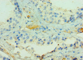 ADAMTSL1 Antibody – Figure 1 of 1