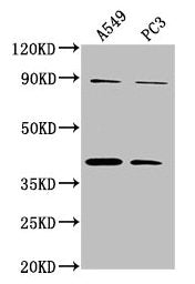 Western Blot
Positive WB detected in: A549 whole cell lysate, PC3 whole cell lysate
All lanes: ATP6V0D2 antibody at 1:2000
Secondary
Goat polyclonal to rabbit IgG at 1/50000 dilution
Predicted band size: 41 kDa
Observed band size: 41 kDa