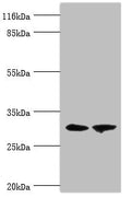 Western blot
All lanes: ACBD4 antibody at 2µg/ml
Lane 1: Mouse kidney tissue
Lane 2: Mouse liver tissue
Secondary
Goat polyclonal to rabbit IgG at 1/10000 dilution
Predicted band size: 31, 35, 38 kDa
Observed band size: 31 kDa
