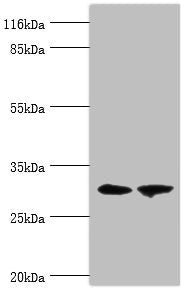 Western blot
All lanes: ACBD4 antibody at 2µg/ml
Lane 1: Mouse kidney tissue
Lane 2: Mouse liver tissue
Secondary
Goat polyclonal to rabbit IgG at 1/10000 dilution
Predicted band size: 31, 35, 38 kDa
Observed band size: 31 kDa