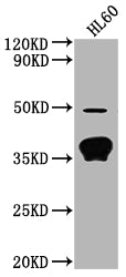 Western Blot
Positive WB detected in: HL60 whole cell lysate
All lanes: OR10P1 antibody at 1:2000
Secondary
Goat polyclonal to rabbit IgG at 1/50000 dilution
Predicted band size: 35 kDa
Observed band size: 35 kDa