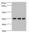 Western blot All lanes: AIMP2 antibody at 5ug/ml Lane 1: Hela whole cell lysate Lane 2: HepG2 whole cell lysate Lane 3: K562 whole cell lysate Secondary Goat polyclonal to rabbit IgG at 1/10000 dilution Predicted band size: 35 kDa Observed band size: 35 kDa