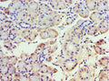 Immunohistochemistry of paraffin-embedded human pancreatic tissue using CSB-PA819884ESR1HU at dilution of 1:100
