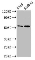 Western Blot
Positive WB detected in: A549 whole cell lysate, Rat kidney tissue
All lanes: AFG1L antibody at 3µg/ml
Secondary
Goat polyclonal to rabbit IgG at 1/50000 dilution
Predicted band size: 55 kDa
Observed band size: 55 kDa