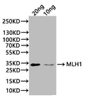 Western Blot
Positive WB detected in: recombinant protein
All lanes:MLH1 Antibody at 1:1000
Secondary
Goat polyclonal to rabbit IgG at 1/20000 dilution
Predicted band size: 33 kDa
Observed band size: 33 kDa