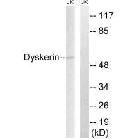 Western blot analysis of extracts from HeLa cells, using Dyskerin antibody.