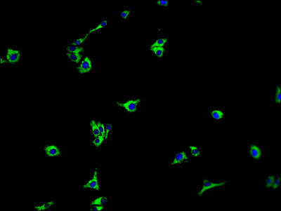 Immunofluorescence staining of HepG2 cells with CSB-PA820182NA01HU at 1:100, counter-stained with DAPI. The cells were fixed in 4% formaldehyde and blocked in 10% normal Goat Serum. The cells were then incubated with the antibody overnight at 4°C. The secondary antibody was Alexa Fluor 488-congugated AffiniPure Goat Anti-Rabbit IgG(H+L).