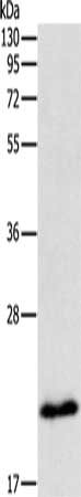 Gel: 10%SDS-PAGE, Lysate: 40 ug, Lane: Raji cells, Primary antibody: CSB-PA821117(MGMT Antibody) at dilution 1/150, Secondary antibody: Goat anti rabbit IgG at 1/8000 dilution, Exposure time: 40 seconds