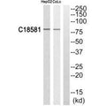 Western blot analysis of extracts from HepG2 cells and COLO205 cells, using NEK5 antibody.