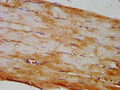 IHC image of CSB-PA821705LA01HU diluted at 1:400 and staining in paraffin-embedded human skeletal muscle tissue performed on a Leica BondTM system. After dewaxing and hydration, antigen retrieval was mediated by high pressure in a citrate buffer (pH 6.0). Section was blocked with 10% normal goat serum 30min at RT. Then primary antibody (1% BSA) was incubated at 4&deg;C overnight. The primary is detected by a biotinylated secondary antibody and visualized using an HRP conjugated SP system.