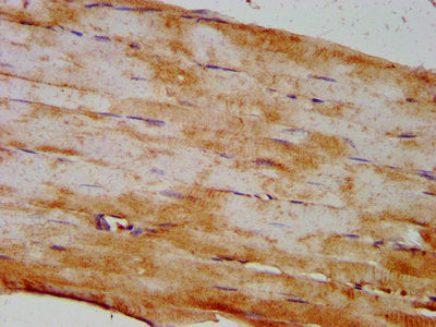 IHC image of CSB-PA821705LA01HU diluted at 1:400 and staining in paraffin-embedded human skeletal muscle tissue performed on a Leica BondTM system. After dewaxing and hydration, antigen retrieval was mediated by high pressure in a citrate buffer (pH 6.0). Section was blocked with 10% normal goat serum 30min at RT. Then primary antibody (1% BSA) was incubated at 4&deg;C overnight. The primary is detected by a biotinylated secondary antibody and visualized using an HRP conjugated SP system.