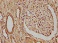 IHC image of CSB-PA822189LA01HU diluted at 1:320 and staining in paraffin-embedded human kidney tissue performed on a Leica BondTM system. After dewaxing and hydration, antigen retrieval was mediated by high pressure in a citrate buffer (pH 6.0). Section was blocked with 10% normal goat serum 30min at RT. Then primary antibody (1% BSA) was incubated at 4°C overnight. The primary is detected by a biotinylated secondary antibody and visualized using an HRP conjugated SP system.
