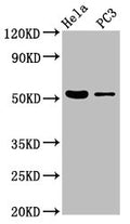 Western Blot
Positive WB detected in: Hela whole cell lysate, PC-3 whole cell lysate
All lanes: CELF6 antibody at 3.7µg/ml
Secondary
Goat polyclonal to rabbit IgG at 1/50000 dilution
Predicted band size: 51, 39, 48, 37 kDa
Observed band size: 51 kDa