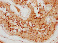IHC image of CSB-PA822692LA01HU diluted at 1:500 and staining in paraffin-embedded human testis tissue performed on a Leica BondTM system. After dewaxing and hydration, antigen retrieval was mediated by high pressure in a citrate buffer&nbsp;(pH 6.0). Section was blocked with 10% normal goat serum 30min at RT. Then primary antibody&nbsp;(1% BSA) was incubated at 4&deg;C overnight. The primary is detected by a biotinylated secondary antibody and visualized using an HRP conjugated SP system.