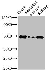 Western Blot
Positive WB detected in: Rat heart tissue, Rat skeletal muscle, Mouse kidney tissue
All lanes: ATP6V1C2 antibody at 3.4ug/ml
Secondary
Goat polyclonal to rabbit IgG at 1/50000 dilution
Predicted band size: 49, 44 kDa
Observed band size: 49 kDa