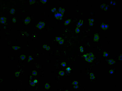 Immunofluorescence staining of HepG2 cells with CSB-PA823450OA01HU at 1:100, counter-stained with DAPI. The cells were fixed in 4% formaldehyde and blocked in 10% normal Goat Serum. The cells were then incubated with the antibody overnight at 4°C. The secondary antibody was Alexa Fluor 488-congugated AffiniPure Goat Anti-Rabbit IgG(H+L).