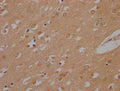 IHC image of CSB-PA823450PA01HU diluted at 1:200 and staining in paraffin-embedded human brain tissue performed on a Leica BondTM system. After dewaxing and hydration, antigen retrieval was mediated by high pressure in a citrate buffer (pH 6.0). Section was blocked with 10% normal goat serum 30min at RT. Then primary antibody (1% BSA) was incubated at 4°C overnight. The primary is detected by a Goat anti-rabbit polymer IgG labeled by HRP and visualized using 0.05% DAB.