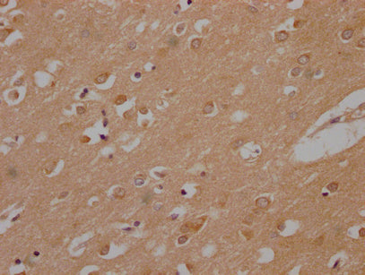 IHC image of CSB-PA823450PA01HU diluted at 1:200 and staining in paraffin-embedded human brain tissue performed on a Leica BondTM system. After dewaxing and hydration, antigen retrieval was mediated by high pressure in a citrate buffer (pH 6.0). Section was blocked with 10% normal goat serum 30min at RT. Then primary antibody (1% BSA) was incubated at 4°C overnight. The primary is detected by a Goat anti-rabbit polymer IgG labeled by HRP and visualized using 0.05% DAB.