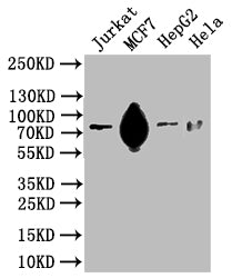 Western Blot
Positive WB detected in: Hela whole cell lysate, HEK293 whole cell lysate, MCF-7 whole cell lysate
All lanes: SLC20A1 antibody at 2.5µg/ml
Secondary
Goat polyclonal to rabbit IgG at 1/50000 dilution
Predicted band size: 74 kDa
Observed band size: 74 kDa