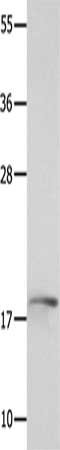 Gel: 12%SDS-PAGE, Lysate: 40 ug, Lane: Mouse kidney tissue, Primary antibody: CSB-PA824161(NME3 Antibody) at dilution 1/800, Secondary antibody: Goat anti rabbit IgG at 1/8000 dilution, Exposure time: 1 minute