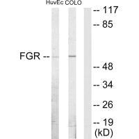 Western blot analysis of extracts from HUVEC cells and COLO205 cells, using FGR antibody.