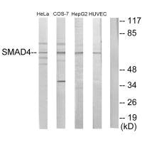 Western blot analysis of extracts from HeLa cells, COS-7 cells, HepG2 cells and HUVEC cells, using Smad4 antibody.