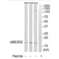 Western blot analysis of extracts from HeLa cells, A549 cells and K562 cells, using UBE2D2 antibody.