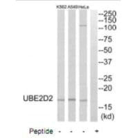 Western blot analysis of extracts from HeLa cells, A549 cells and K562 cells, using UBE2D2 antibody.