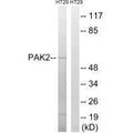 Western blot analysis of extracts from HT-29 cells, using PAK2 (Ab-197) antibody.
