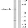Western blot analysis of extracts from LOVO cells, using osteopontin antibody.