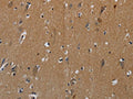 The image on the left is immunohistochemistry of paraffin-embedded Human brain tissue using CSB-PA827787(PIK3CG Antibody) at dilution 1/50, on the right is treated with synthetic peptide. (Original magnification: ×200)