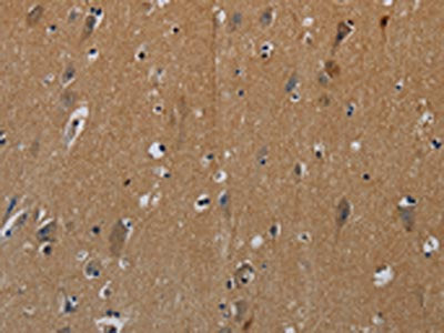 The image on the left is immunohistochemistry of paraffin-embedded Human brain tissue using CSB-PA827787(PIK3CG Antibody) at dilution 1/50, on the right is treated with synthetic peptide. (Original magnification: ×200)